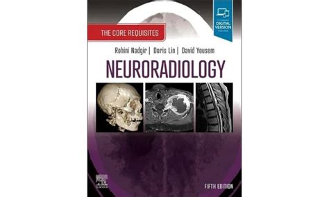Buy Neuroradiology: The Core Requisites Book Online at Low Prices in ...