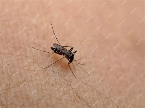 Image result for Insect Removal From Humans