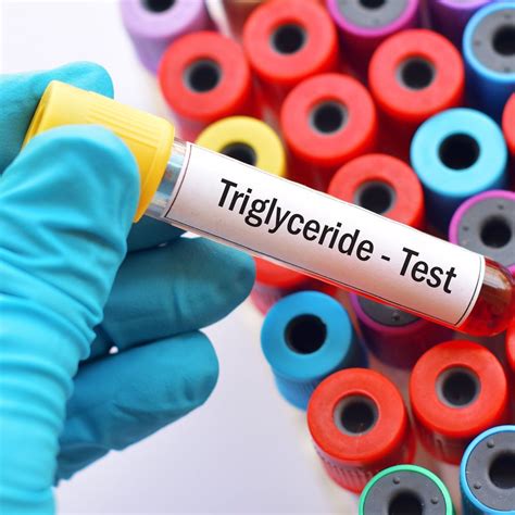 Triglyzeridsenkung – wichtige Fortschritte präsentiert - Kardiologie ...
