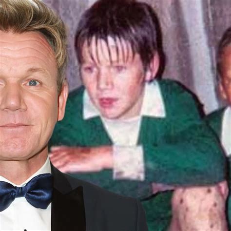 Gordon Ramsays Recipe For Youth Celebrity Surgery