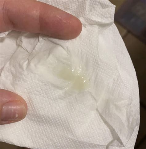 Jelly Like Discharge Early Pregnancy Cervix | Uterine Or Cervical