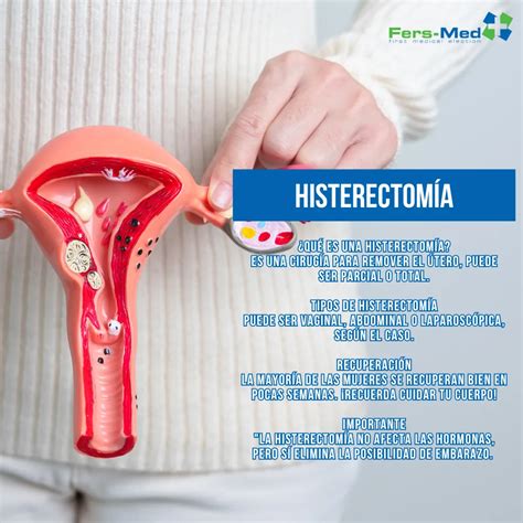 Histerectomía: Qué es y cuándo se realiza