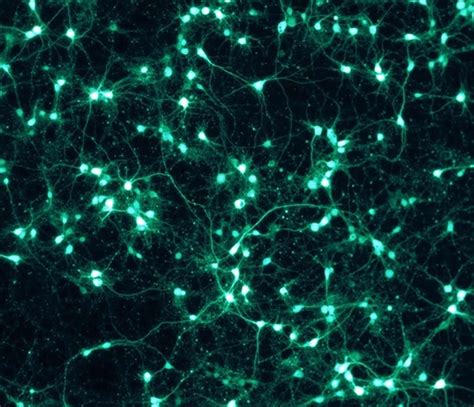 Processing Neural Networks 的图像结果