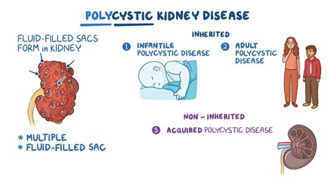 Video: Polycystic kidney disease (PKD): Nursing | Osmosis