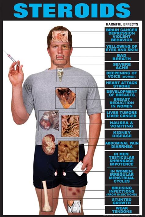 Infographic on steroids – Artofit