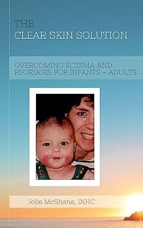 The Clear Skin Solution: Overcoming Eczema & Psoriasis for Infants ...