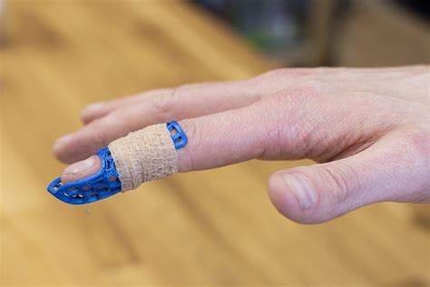 Image result for Finger Extension Splint
