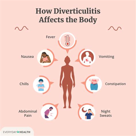 Diverticulitis Complications