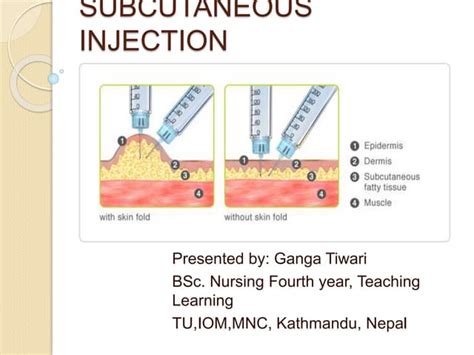 Image result for Subcut Injection OSCE