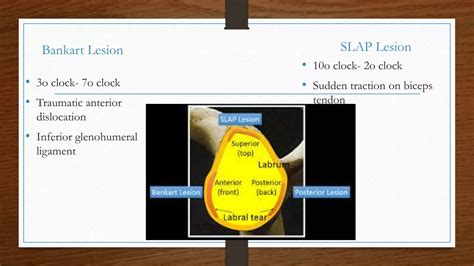 Labrum Test 的图像结果