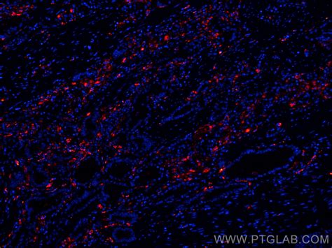 PSAP antibody (CL594-66473) | Proteintech