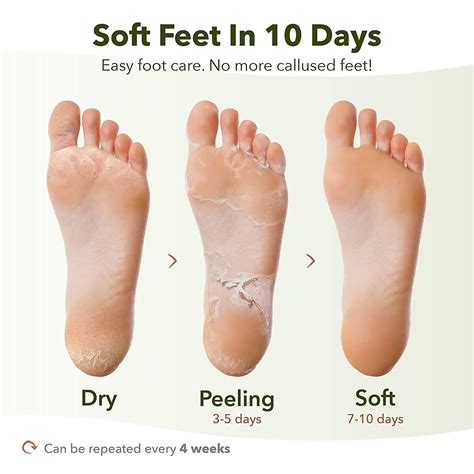 Shedding Skin On Feet