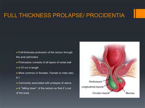 Images Of Anal Prolapse