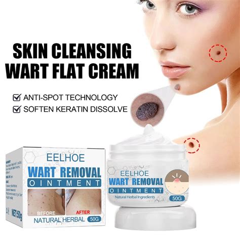Wart Removal Cream Safe Painless Skin Tags Removal Ointment Fast Acting Remover Cream for Warts ...