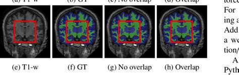 Image result for Overlapping Memory Segmentation