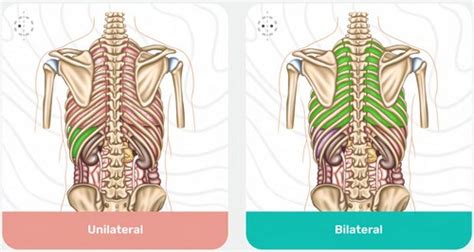 Image result for Contralateral Body Parts Example