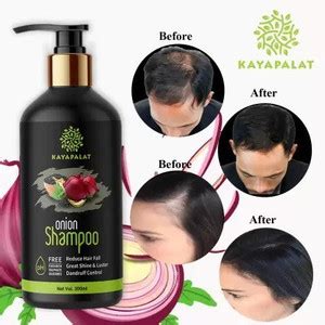KAYAPALAT Anti Hair Fall Red Onion & Black Seed Nourishment Shampoo ...