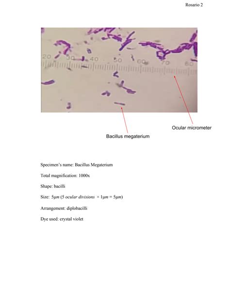 Image result for Simple Stain Procedure
