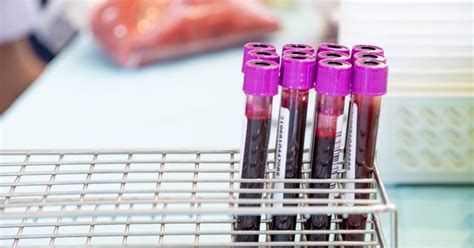 Portland-Area Lab Workers Win First Labor Deal