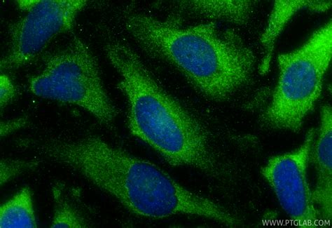 Collagen Type X antibody (26984-1-AP) | Proteintech