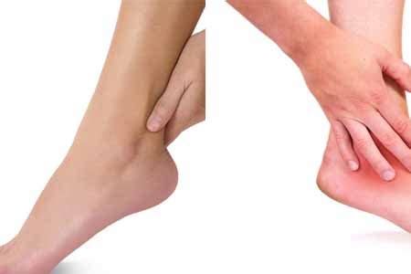 脚踝无缘无故肿痛怎么办 掌握正确的治疗方法是关键_伊秀健康|yxlady.com