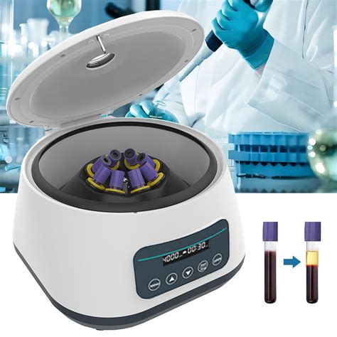 Nyans Lab Benchtop Prp Centrifuges Desktop Electric Lab Laboratory ...