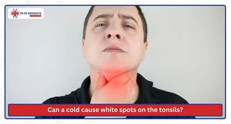 What do white patches on tonsils indicate? Learn its signs, causes, and treatment options