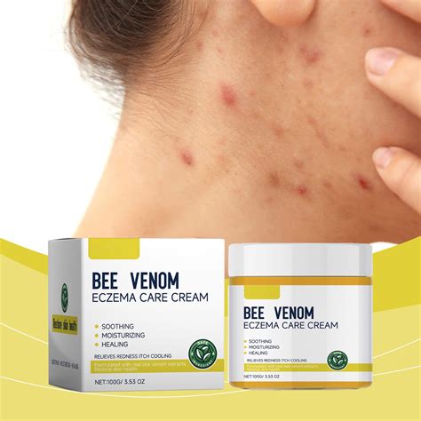 Eczema Anti-itch Cream For Dry Skin-Rosacea Face Rash Cream-Itch ...