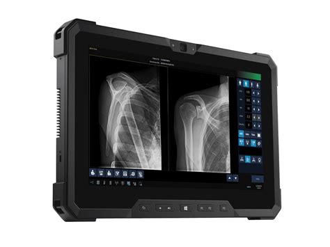 DELWORKS fit | Great Lakes Imaging