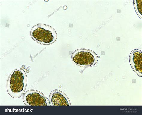 Necator Americanus Rhabditiform Larvae