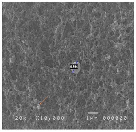The Role of Scanning Electron Microscopy in the Evaluation of ...