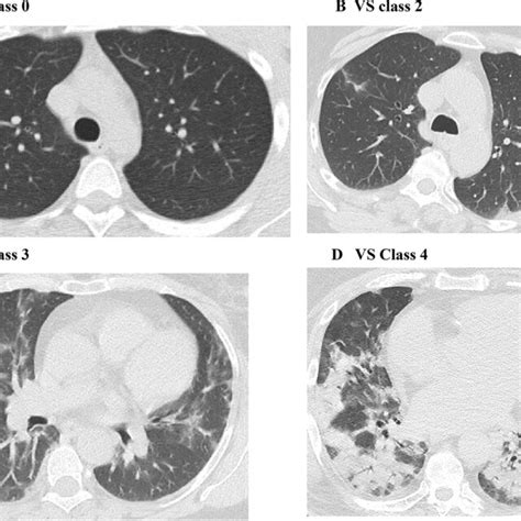 CT Scan Example 的图像结果