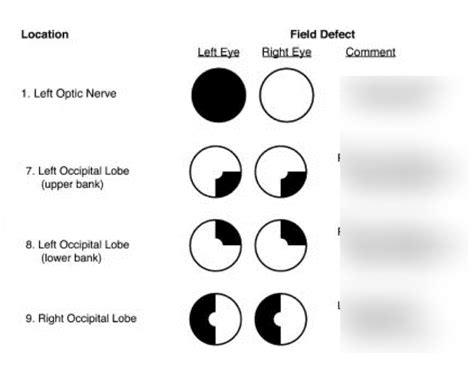 Image result for Visual Spatial Disorder