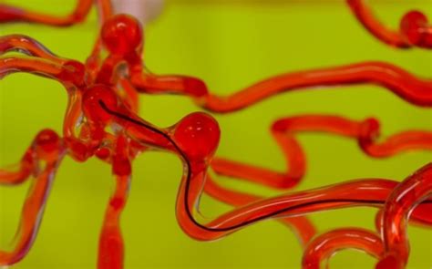 This Thread-like Robot Can Move Through Blood Vessels In Your Brain ...