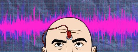 Image result for Single Fiber EMG Test