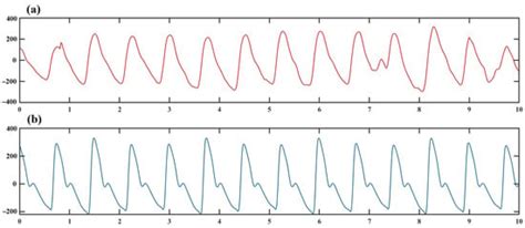 Intelligent Detection Method of Atrial Fibrillation by CEPNCC-BiLSTM ...