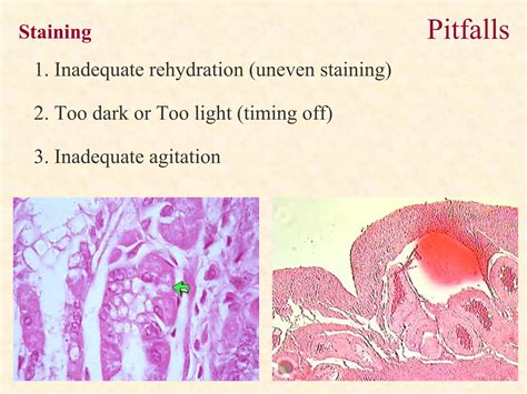 Tissue Processing in Histopathology 的图像结果