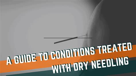 A Guide to Conditions Treated with Dry Needling | Onward Physical Therapy