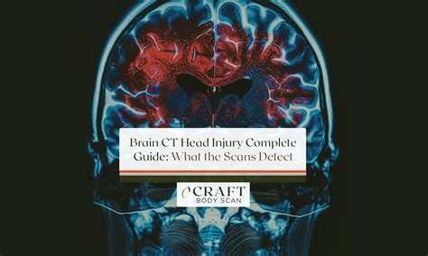Understanding Chronic Small Vessel Ischemic Disease