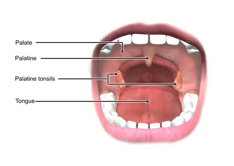 Location Of Tonsils In Throat _ Tonsil Throat – PPWBP