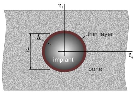 Analytical Modeling of the Interaction of a Four Implant-Supported ...
