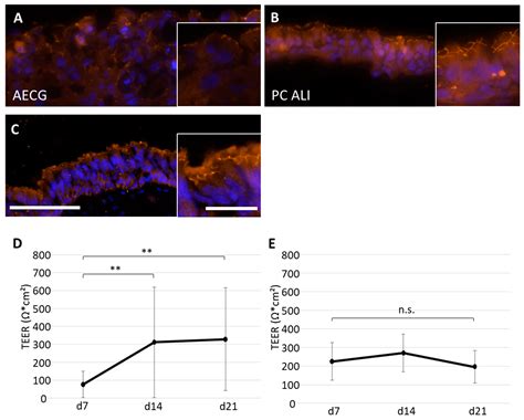 Optimization of Primary Human Bronchial Epithelial 3D Cell Culture with ...