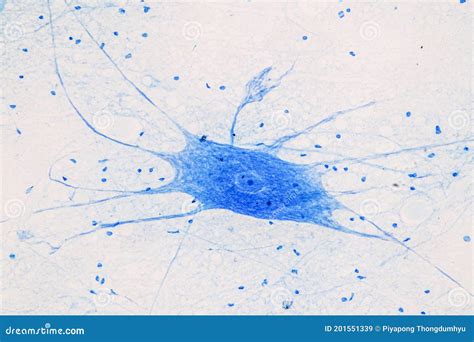 Motor Neuron Under the Microscope. Stock Image - Image of dendrites ...