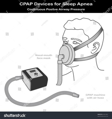 Image result for CPAP and BiPAP Machine Drawing