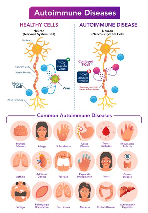Autoimmunity 的图像结果