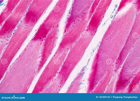 Histological Sample Striated Skeletal Muscle of Mammal Tissue Under the ...