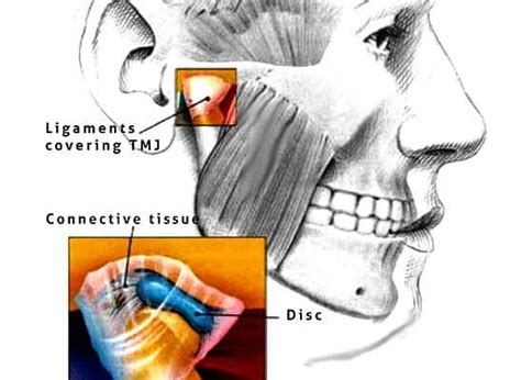 Lockjaw: लॉकजॉ क्या है? जानिए इसके लक्षण और इलाज का तरीका- हैलो स्वास्थ्य