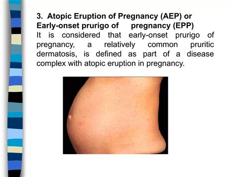 Skin changes and diseases in pregnancy | PPTX