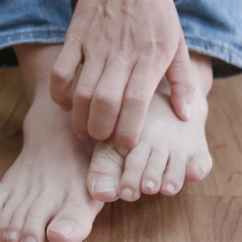 What is Moccasin Tinea Pedis? - Footcare Scotland