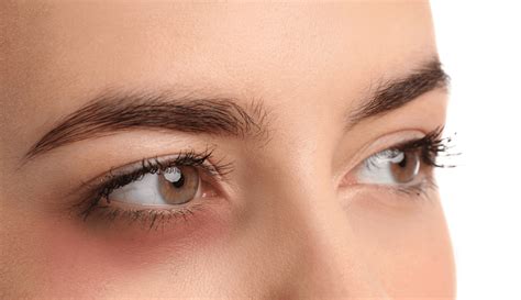 Under Eye Bumps, Wrinkles and Dark Circles - Dermabiotecnica